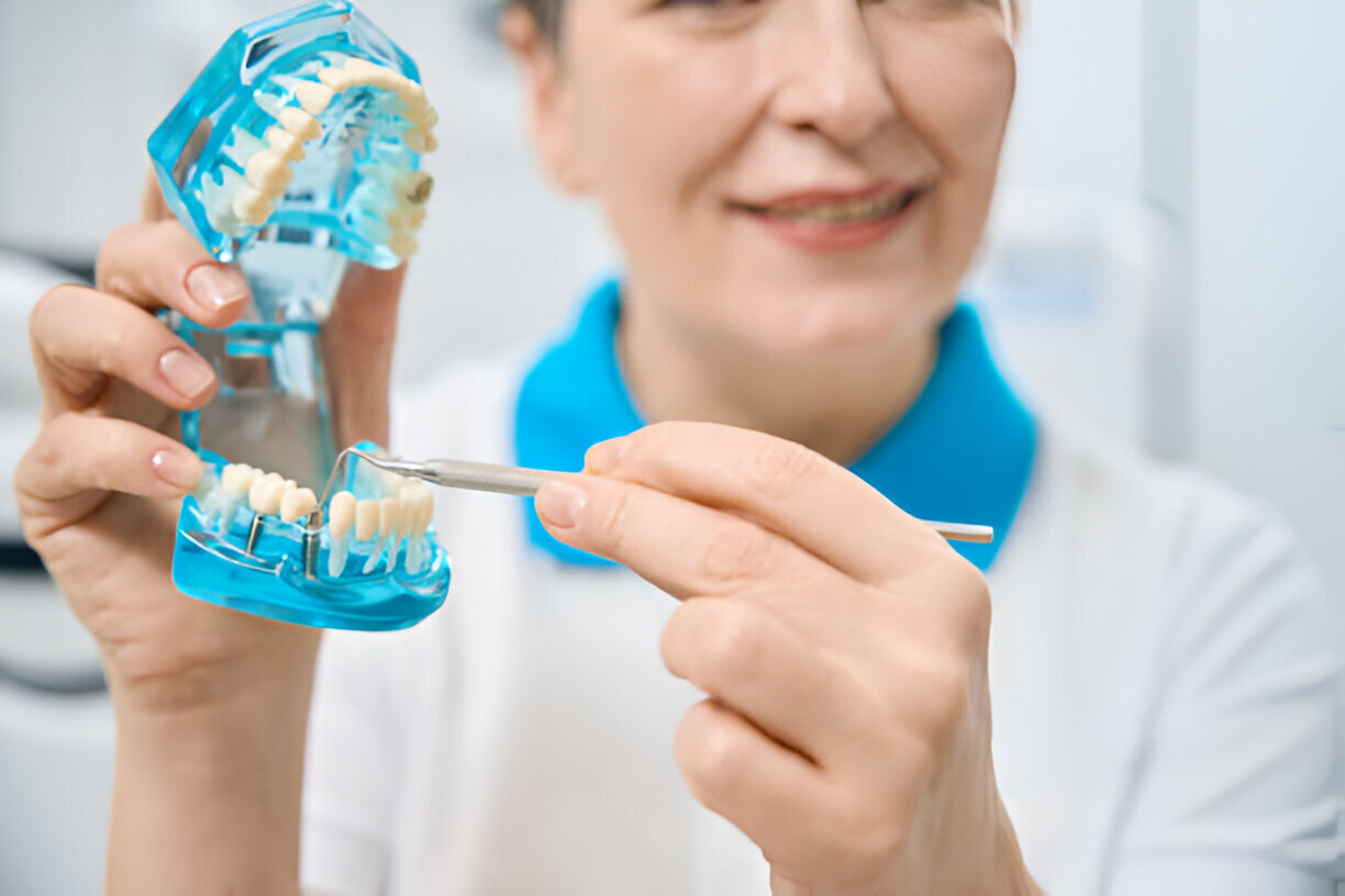 The Ultimate Guide to Dental Implants: Everything You Need to Know_3