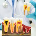 Root Canal Therapy Explained: What to Expect at Carolina Coast Family Dentistry in Shallotte, NC_FI